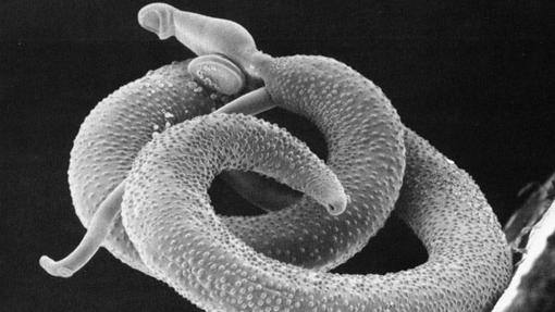 El Schistosoma mansoni alcanza el intestino grueso