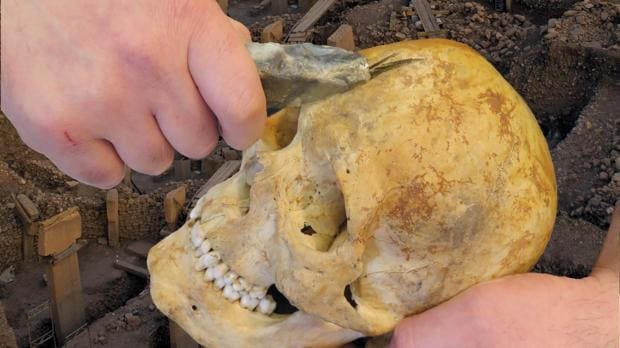 Recreación de la modificación de un cráneo en Göbekli Tepe