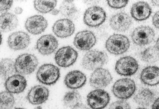 Un elevado porcentaje del ADN humano es de origen viral. Estos microbios han tenido un importante papel en la evolución de nuestra especie