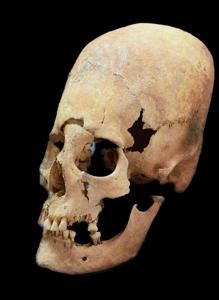 El misterio de las novias búlgaras con los cráneos alargados