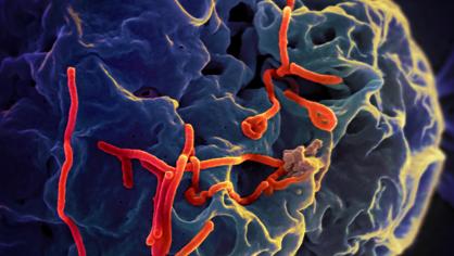 Imagen de microscopio electrónico de virus del ébola unidos a una célula