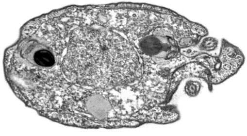 Ancoracysta twista. Un pequeño organismo unicelular de origen desconocido, pues se ha hallado en un acuario tropical de San Diego