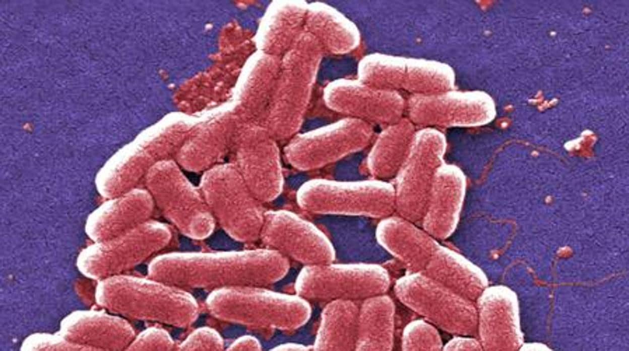 Fotografía de bacterias «Escherichia coli»