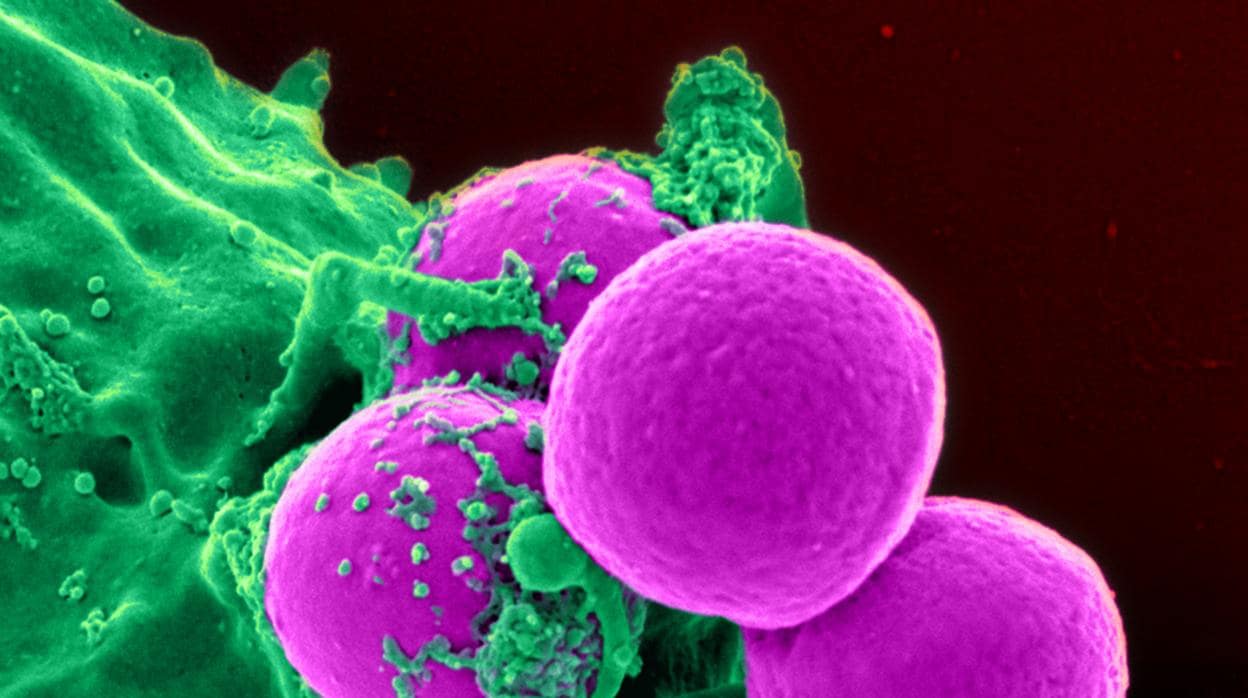 Fotografía coloreada de una célula ingiriendo varias bacterias MRSA (en rosa)