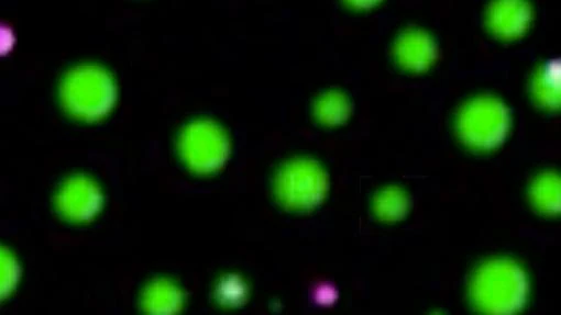 Gotitas de líquido formadas dentro de una célula y marcadas con moléculas fluorescentes