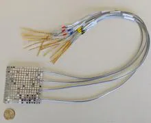 Electrodos intracraneales del tipo utilizado para registrar la actividad cerebral en el estudio