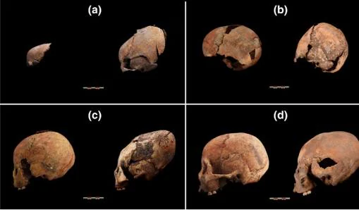 Los hombres con cráneos de alien de hace 12.000 años