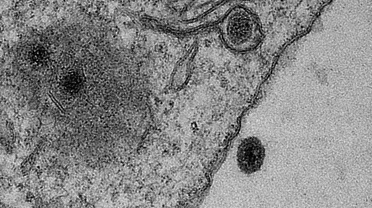 En tonos oscuros, el nuevo Yaravirus, toda una sorpresa para los científicos