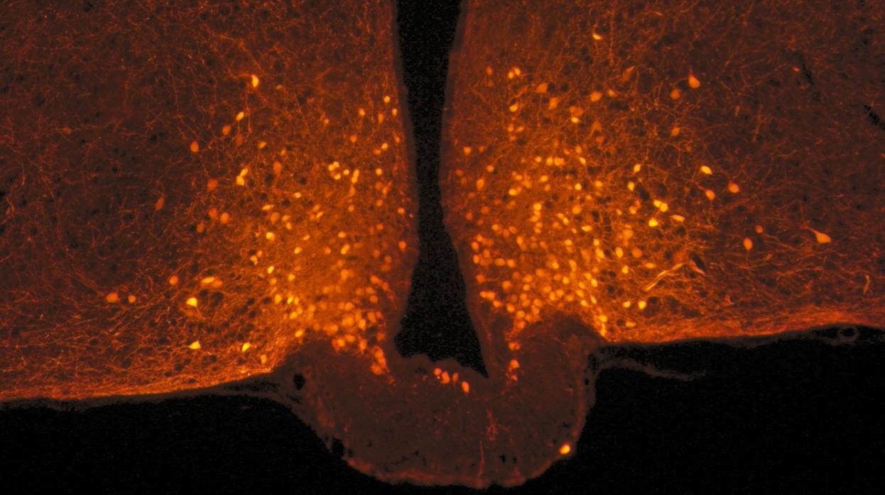En la imagen, de color naranja, un tipo de neuronas que se activan al comer en un cerebro de ratón