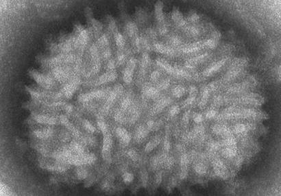 Virus vaccinia al microscopio electrónico