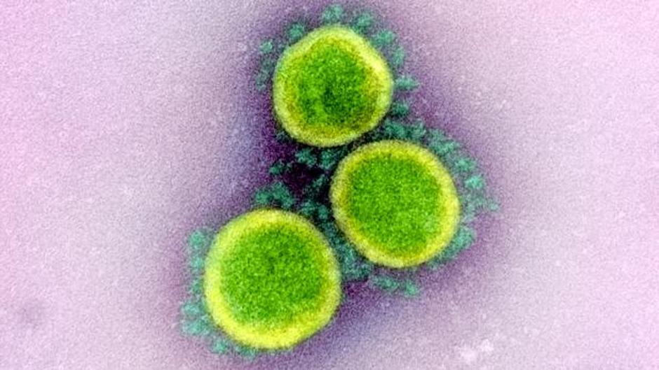 Científicos estadounidenses descubren una posible forma de evitar que el coronavirus infecte a la célula