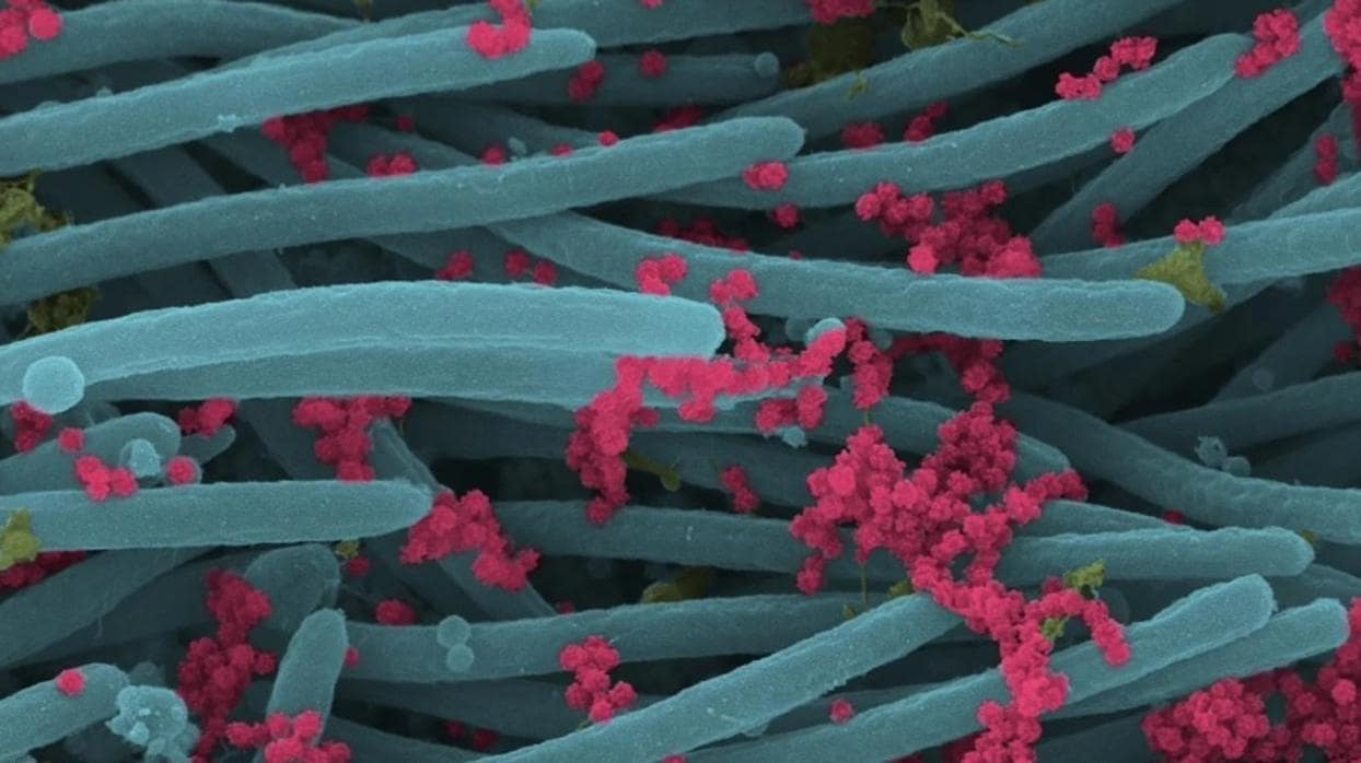 Partículas del virus en rosa, sobre cilios de células del sistema respiratorio, en azul