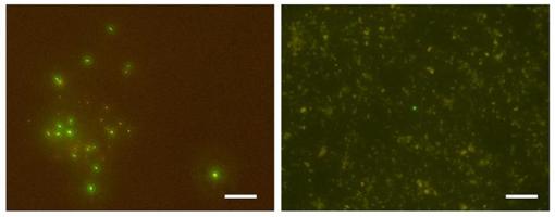 Micrografía de fluorescencia de células microbianas submarinas profundas detectadas en la perforación. Las células se tiñeron con un tinte verde fluorescente. Izquierda: Células microbianas separadas de una muestra de núcleo de sedimento a una profundidad de 652,0 ma 76 ° C. Derecha: una célula microbiana detectada a partir de una muestra de núcleo de sedimento a una profundidad de 1176,8 ma 120 ° C (una célula en el centro de la imagen). La escala indica 20 micrómetros (1/50 de milímetro).