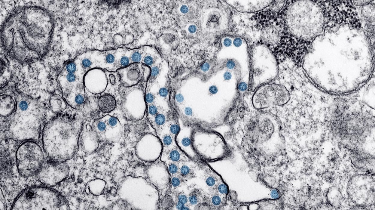 Partículas del virus SARS-CoV-2, coloreadas en azul, en una imagen de microscopio de electrones