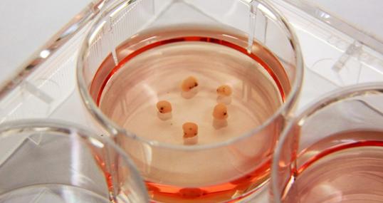 Los organoides cerebrales 3D simplificados se pueden cultivar en un plato utilizando células madre humanas como material de partida.