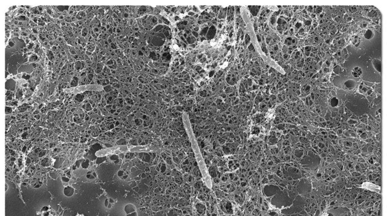 Candidatus Desulforudis audaxviator en una imagen de archivo