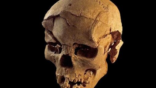 Cráneo de un hombre con múltiples lesiones causadas por un objeto contundenteo