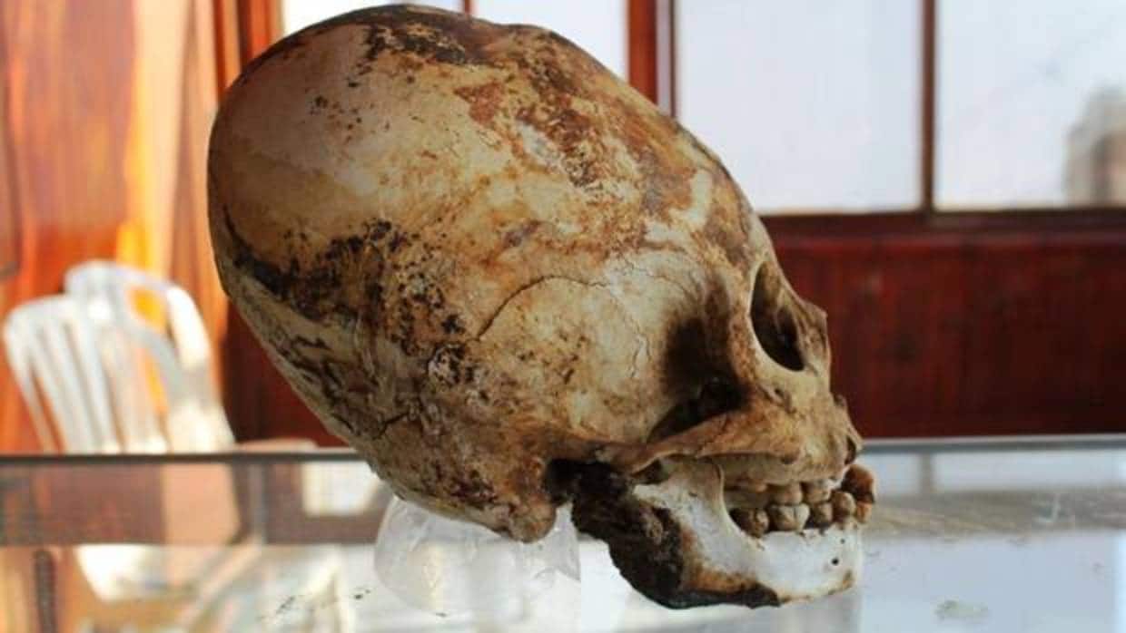 Cráneo de un poblador de la cultura prehispánica de Tiahuanaco