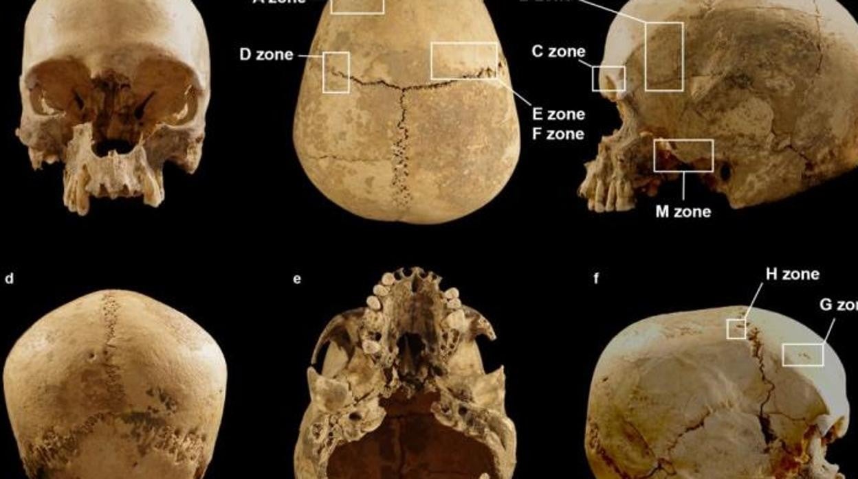 Vistas frontal, superior, izquierda, posterior, inferior y derecha del cuadro. Los recuadros indican las zonas con lesiones