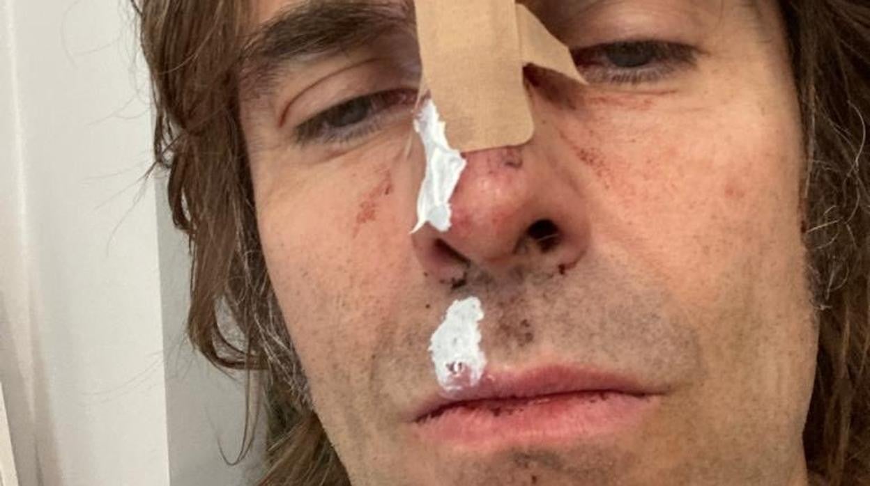 Liam Gallagher sobrevive a un accidente de helicóptero y lo celebra con cerveza española