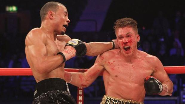 El boxeador Nick Blackwell sale de su segundo coma en menos de un año