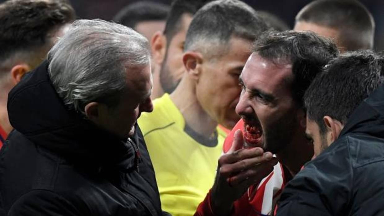 Diego Godín tras la acción con Neto que le dejó sibn tres dientes