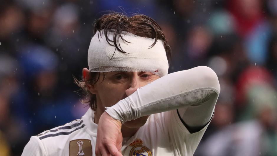 El brutal golpe que dejó a Modric sangrando en el Real Madrid 2-0 Sevilla