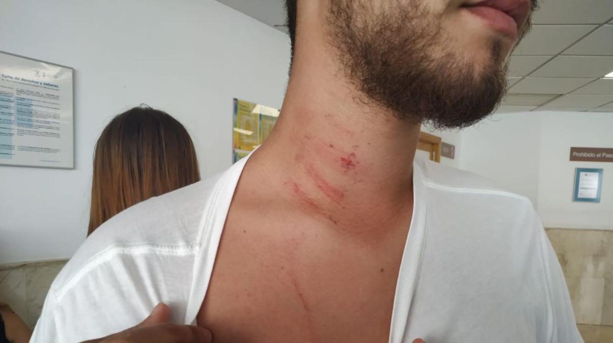 El joven colegiado Abel Gabriel Bayard Ullén fue agredido por un padre.