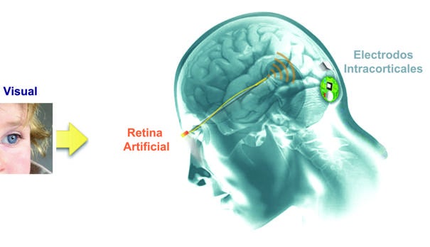 Desarrollan una retina artificial para que los invidentes puedan orientarse en casa
