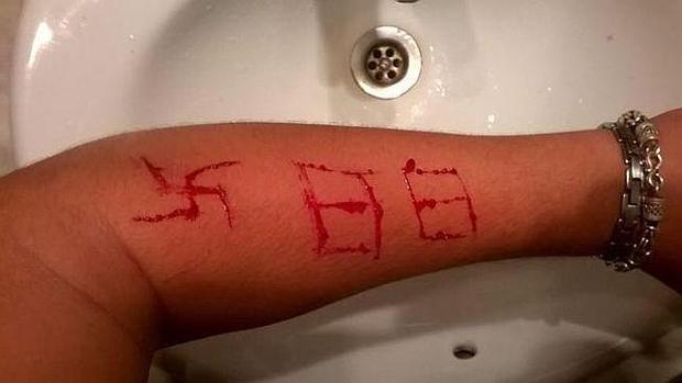 Imagen del brazo de la supuesta víctima difundida a través de las redes sociales