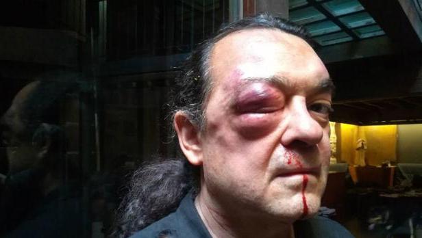 Dos detenidos en relación con la agresión a Fernando Barredo, de Podemos