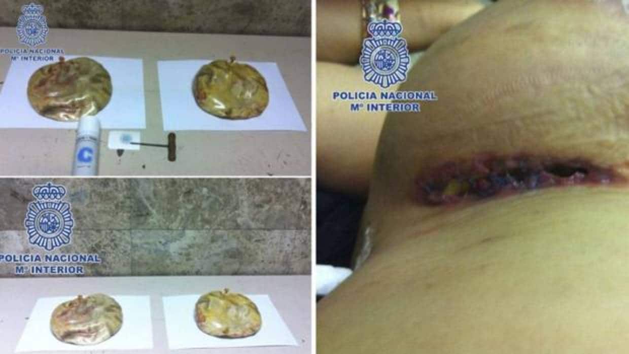 Implantes mamarios detectados por el Cuerpo Nacional de Policía