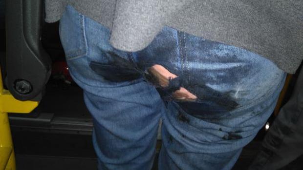 Localizan a la mujer que derramó ácido en un autobús y quemó a dos pasajeros