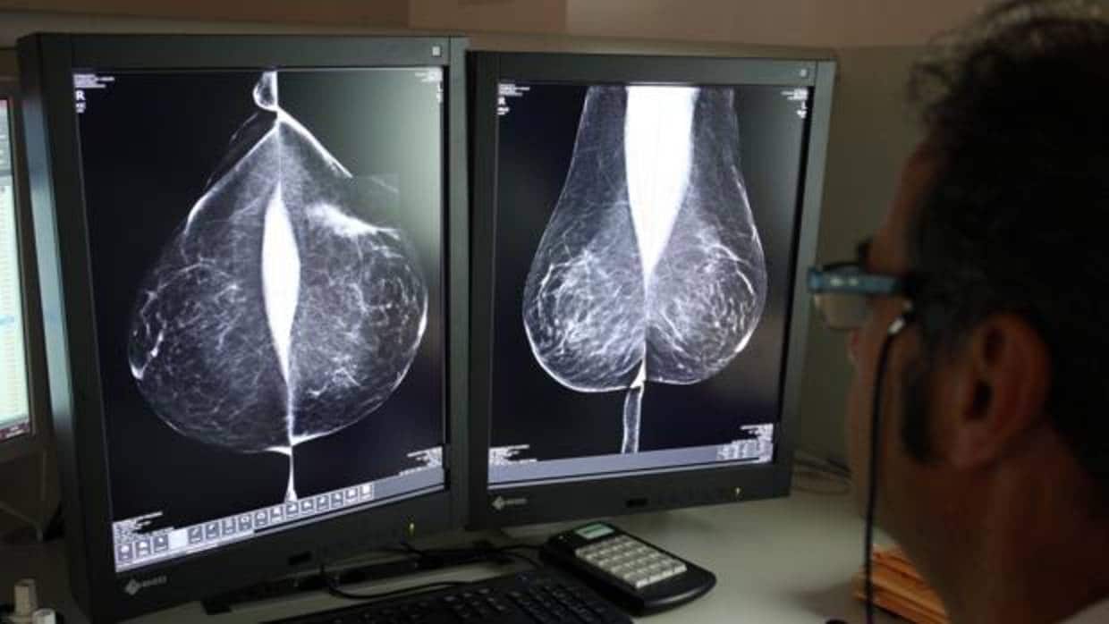 Colon, próstata, pulmón y mama suman la mitad de cánceres en Castilla y León