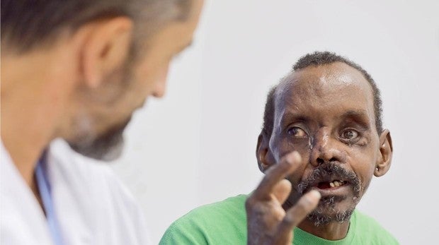Nuevo «milagro» del doctor Pedro Cavadas: reconstruye el rostro de un hombre atacado por una hiena
