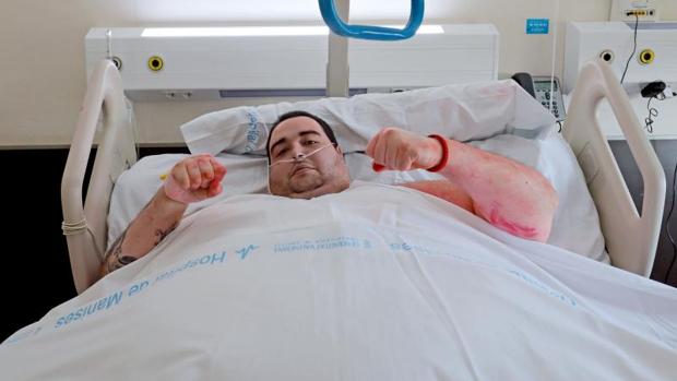 Teo, el valenciano con obesidad mórbida, recibe el alta tras adelgazar 95 kilos en tres meses