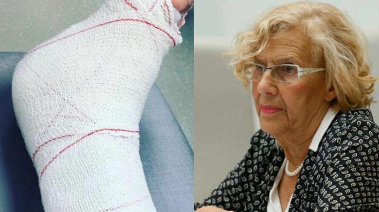 El pie escayolado de la alcaldesa Manuela Carmena