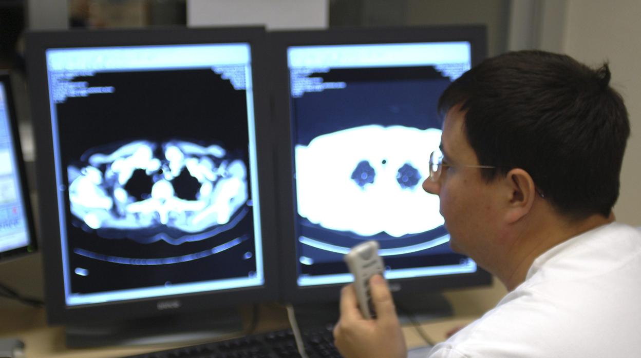 Una de cada tres pruebas de radiología es «innecesaria»