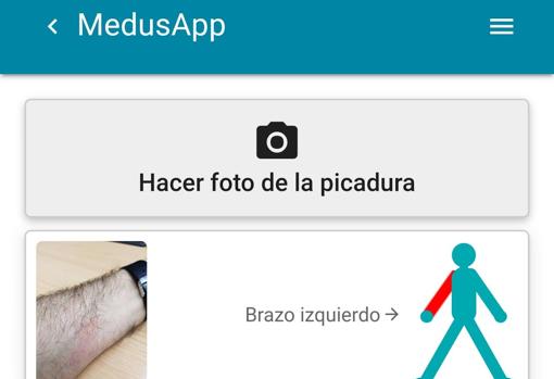 Imagen de una de las novedades de la aplicación «Medusapp»