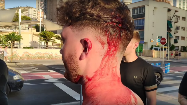 Brutal paliza a un turista británico en Benidorm por alertar de la estafa de unos trileros