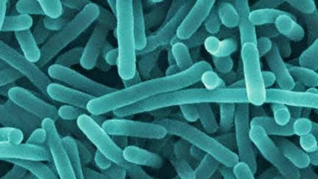 Estudian un posible caso de listeriosis en Segovia