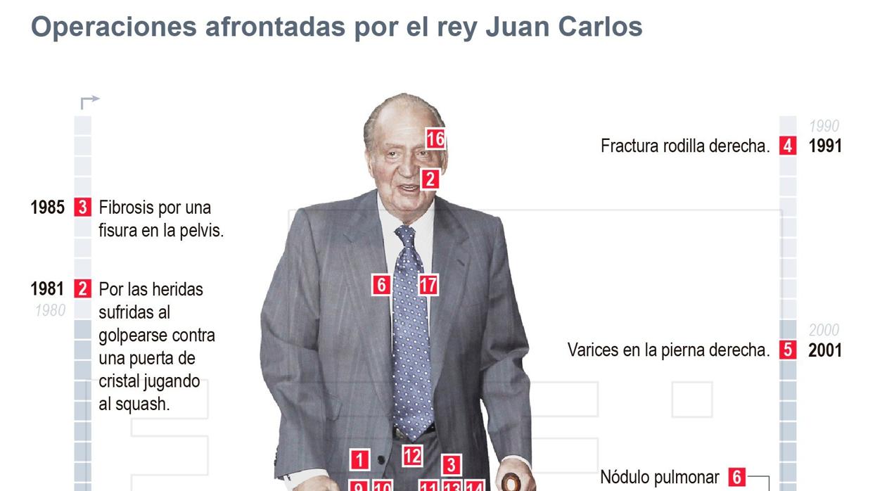 Infografía de todas las operaciones a las que se ha sometido Don Juan Carlos