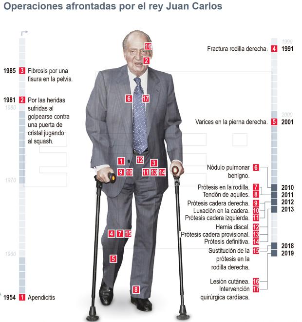 Las 17 operaciones de Don Juan Carlos