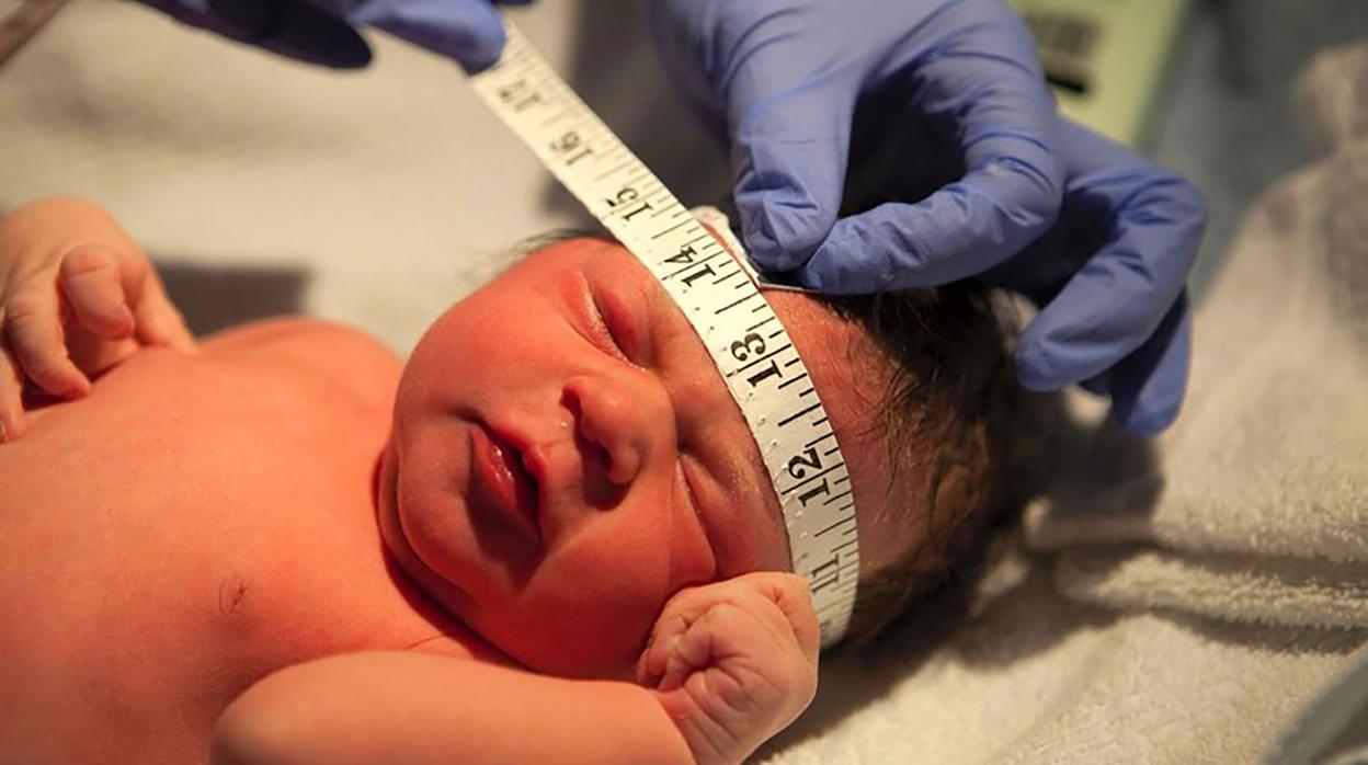 Un pediatra mide el perímetro craneal de un recién nacido