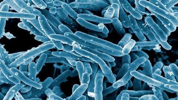 Se confirma un nuevo caso de tuberculosis en un centro educativo de Albacete