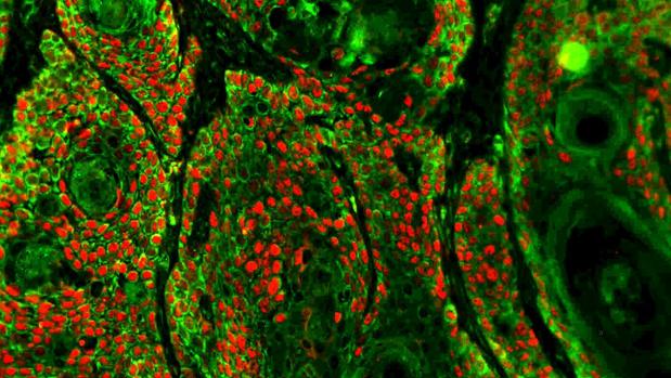 ¿De qué mueren los gallegos?