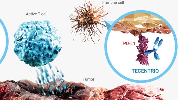 Un virus para frenar el cáncer de mama