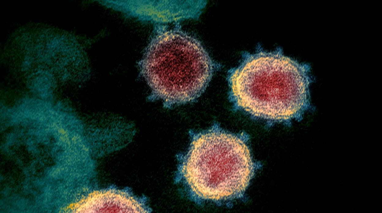 Imágenes de microscopio del coronavirus responsable de la pandemia del Covid-19