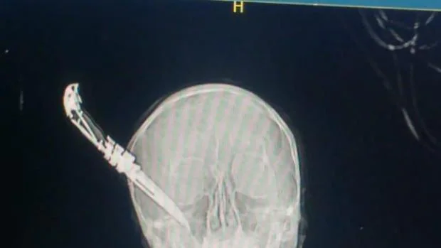 Un joven clava un cuchillo en la cabeza a un hombre de 60 años que quería evitar el robo de una bici en Guecho
