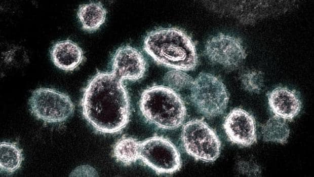 Cinco muertos y 17 nuevos casos de coronavirus en la región